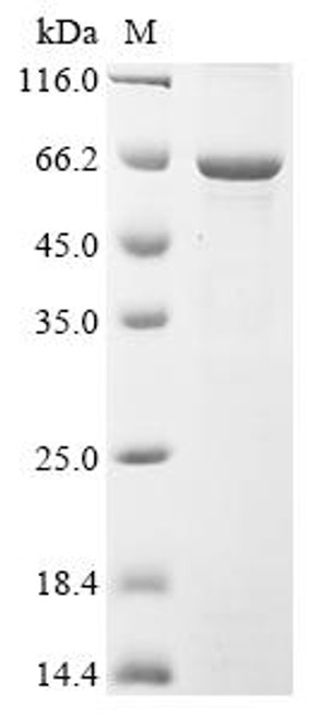 Recombinant Human Transcription factor E2F1 (E2F1) (CSB-EP007340HU)