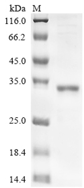 Recombinant Human FAS-associated death domain protein (FADD) (CSB-EP623788HU)