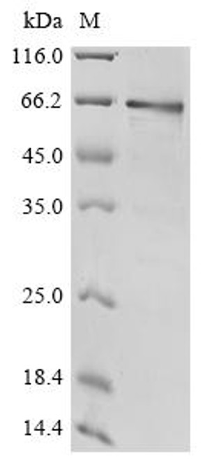 Recombinant Human Protocadherin Fat 1 (FAT1), partial (CSB-EP614532HU)