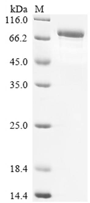 Recombinant Human TNFAIP3-interacting protein 1 (TNIP1) (CSB-EP619959HUb1)