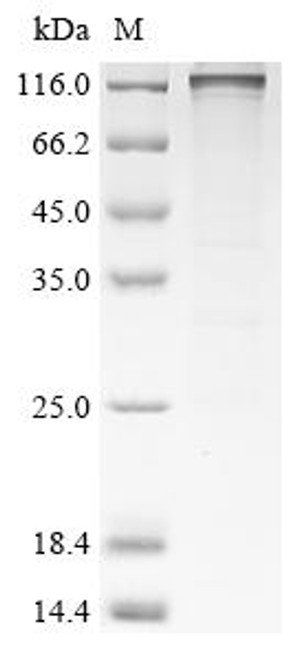 Recombinant Human Disks large-associated protein 5 (DLGAP5) (CSB-EP622997HU(A4))