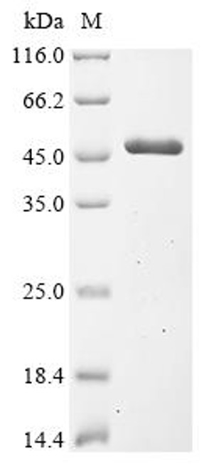 Recombinant Escherichia coli S- (hydroxymethyl)glutathione dehydrogenase (frmA) (CSB-EP635141EGW)