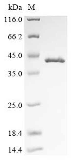 Recombinant Bovine Malate dehydrogenase, cytoplasmic (MDH1),Escherichia Coli (CSB-EP660995BO)