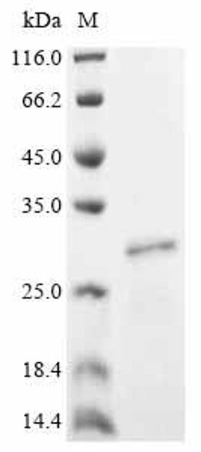 Recombinant Human Peroxisome proliferator-activated receptor gamma coactivator 1-beta (PPARGC1B), partial (CSB-EP769812HU)