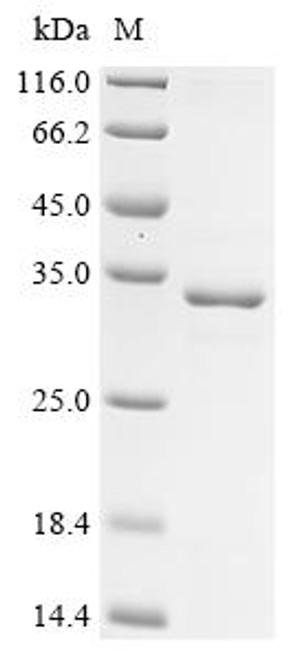 Recombinant Mouse Mucin-4 (Muc4), partial (CSB-EP816958MO)