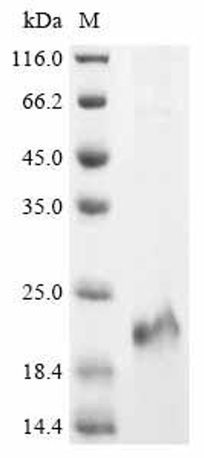 Recombinant Human Protein cereblon (CRBN), partial (CSB-EP842761HU1)