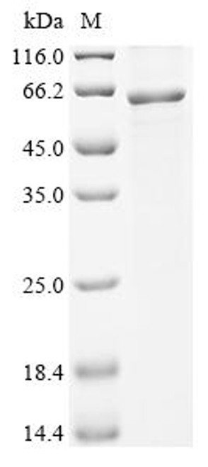Recombinant Human Thioredoxin-interacting protein (TXNIP),Escherichia Coli (CSB-EP880966HU)