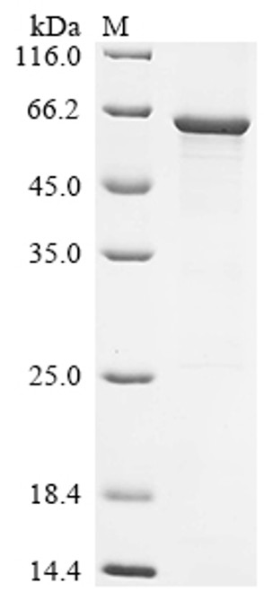 Recombinant Human O-phosphoseryl-tRNA (Sec) selenium transferase (SEPSECS) (CSB-EP888032HU)