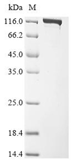 Recombinant Acidaminococcus sp. CRISPR-associated endonuclease Cas12a (cas12a) (CSB-EP3654GPA(A4)) Recombinant Acidaminococcus sp. CRISPR-associated endonuclease Cas12a (cas12a) (CSB-EP3654GPA(A4))