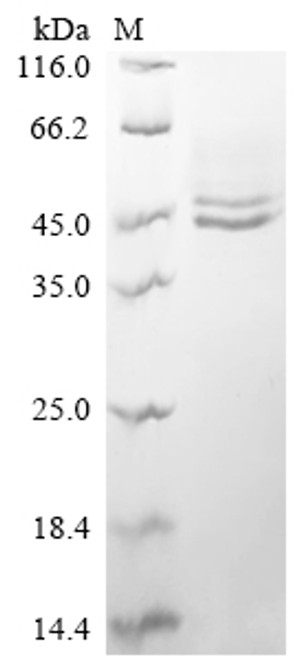 Recombinant Human Interleukin-12 subunit beta (IL12B) (CSB-YP011587HU)