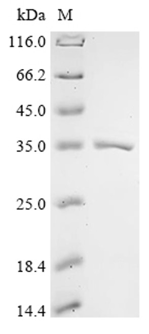 Recombinant Escherichia coli O45:K1 Aspartate carbamoyltransferase (pyrB) (CSB-YP487815EOK)
