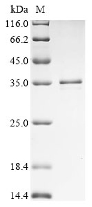 Recombinant Human Ras-related protein Rab-12 (RAB12) (CSB-YP753710HU)