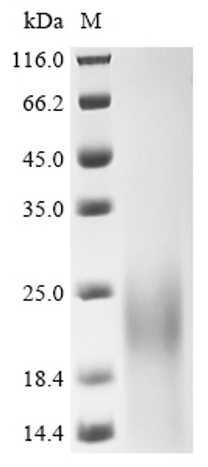 Recombinant Streptococcus mutans serotype c Glucosyltransferase-I (gtfB), partial (CSB-YP357547FMR)