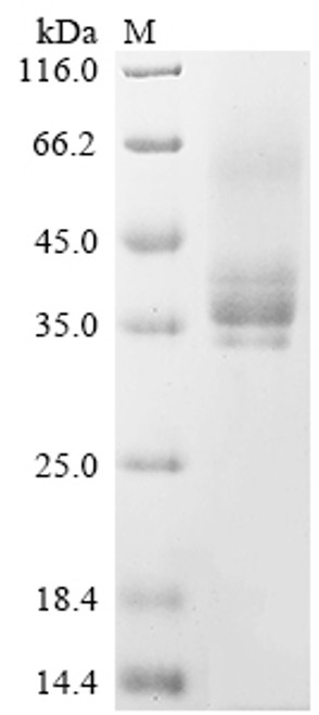 Recombinant Human Methyl-CpG-binding domain protein 2 (MBD2), partial (CSB-YP890654HU1)