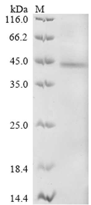 Recombinant Human Receptor-type tyrosine-protein kinase FLT3 (FLT3), partial (CSB-BP008733HU1a0)