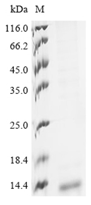Recombinant Human metapneumovirus Fusion glycoprotein F0 (F), partial (CSB-BP751041HDAM1)
