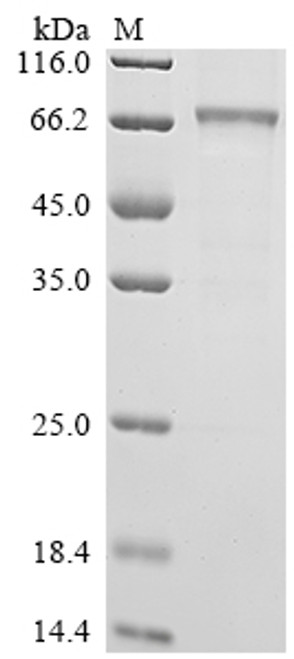 Recombinant Human Interleukin-12 receptor subunit beta-1 (IL12RB1), partial (CSB-BP011588HU1)