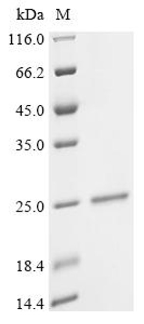Recombinant Human Epididymal-specific lipocalin-6 (LCN6) (CSB-EP012817HU)
