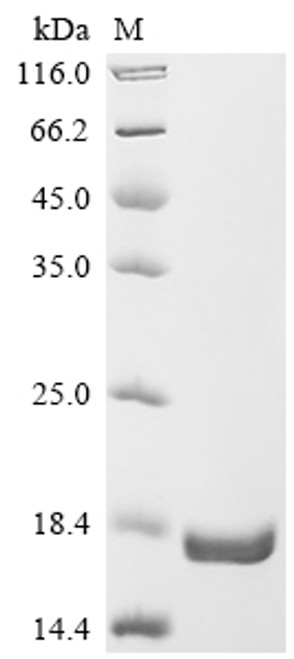 Recombinant Human Anoctamin-1 (ANO1), partial (CSB-EP713621HU2)