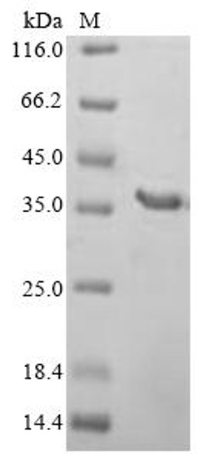 Recombinant Human Protein C1orf43 (C1orf43), partial (CSB-EP874824HU1)