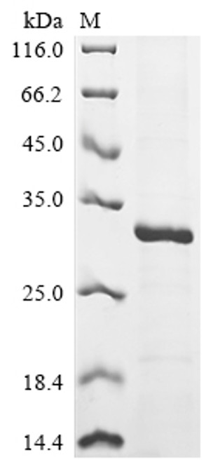 Recombinant Human Interleukin-9 (IL9) (CSB-EP011675HU)