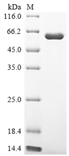 Recombinant Human Receptor-interacting serine/threonine-protein kinase 2 (RIPK2) (CSB-EP019736HUc7)