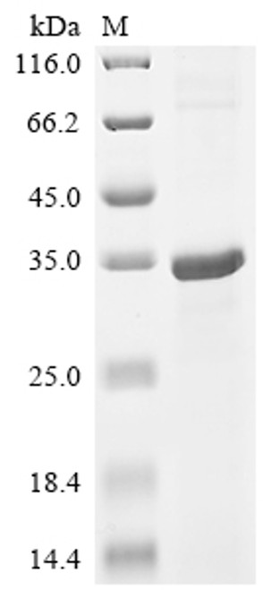Recombinant Human Cathepsin W (CTSW) (CSB-EP006205HU)