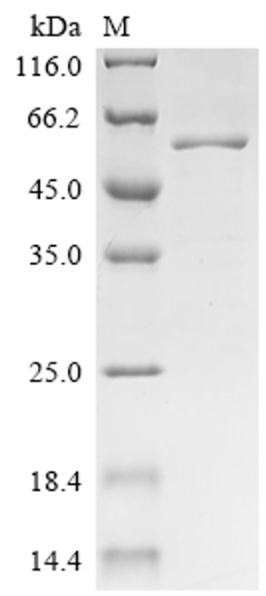 Recombinant Human Scaffold protein ILK (ILK) (CSB-EP619764HU)