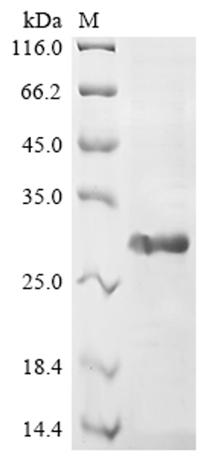 Recombinant Human Vascular endothelial growth factor B (VEGFB), partial (CSB-EP025834HU1a2)