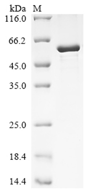 Recombinant Human Hyaluronan and proteoglycan link protein 1 (HAPLN1) (CSB-EP010130HUa2)