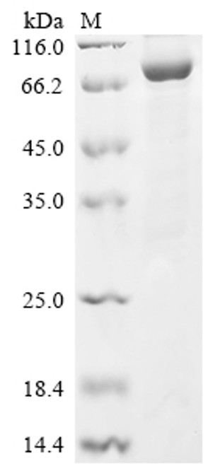 Recombinant Human Prolyl endopeptidase FAP (FAP), partial (CSB-EP008424HUa0)