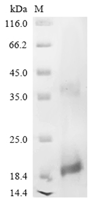 Recombinant Human Slit homolog 3 protein (SLIT3), partial (CSB-EP021769HU)