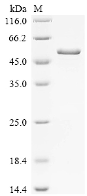 Recombinant Hypsizygus marmoreus Putative epoxide hydrolase (Hypma_001463) (CSB-EP4654GSX)