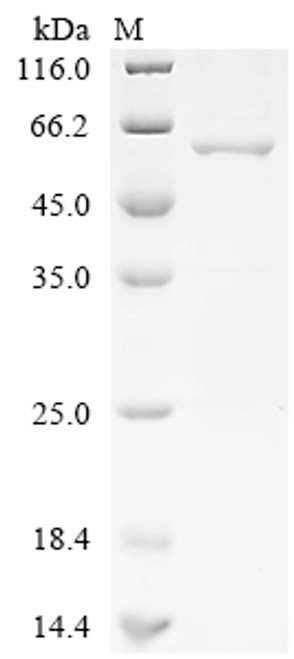 Recombinant Human Proteasome activator complex subunit 3 (PSME3), partial (CSB-EP018918HU1c0)