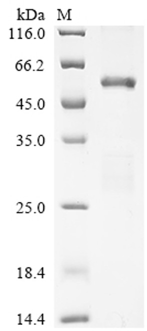 Recombinant Mouse Histone acetyltransferase p300 (Ep300), partial (CSB-EP007702MOb1)