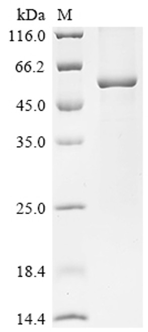 Recombinant Human Acyloxyacyl hydrolase (AOAH) (CSB-EP001853HU)