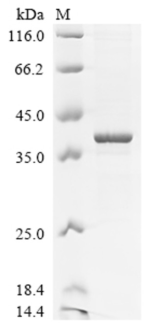 Recombinant Mouse Dexamethasone-induced Ras-related protein 1 (Rasd1) (CSB-EP019354MO(A4))