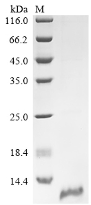 Recombinant Human Claudin-18.2 (CLDN18.2), partial (CSB-EP005498HU2b0)