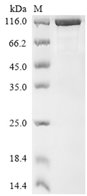 Recombinant Human Nuclear pore complex protein Nup85 (NUP85) (CSB-EP874821HUl9)