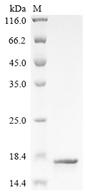 Recombinant Human T cell receptor beta variable 19 (TRBV19) (CSB-EP4712HU)