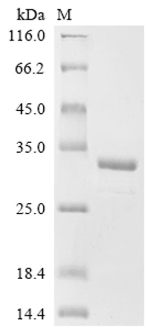 Recombinant Human Eukaryotic translation initiation factor 5B (EIF5B), partial (CSB-EP007581HU)