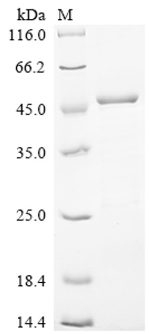 Recombinant Human Myosin regulatory light chain 12B (MYL12B) (CSB-EP015308HU)