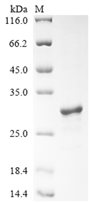 Recombinant Pig Ubiquitin carboxyl-terminal hydrolase isozyme L1 (UCHL1), partial (CSB-EP747573PI)