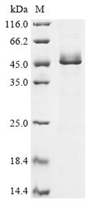 Recombinant Human Glia-derived nexin (SERPINE2) (CSB-EP021082HUc7)