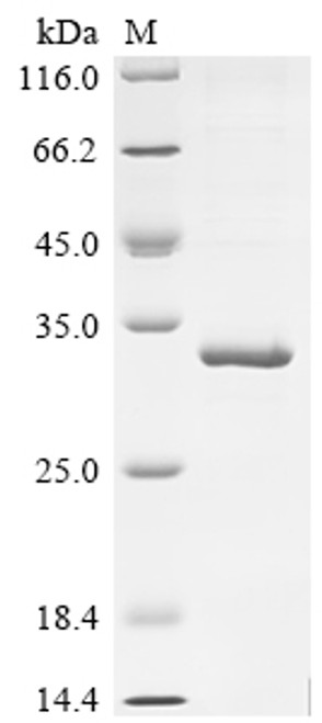 Recombinant Human Interferon alpha-2 (IFNA2) (CSB-EP360706HUe3)