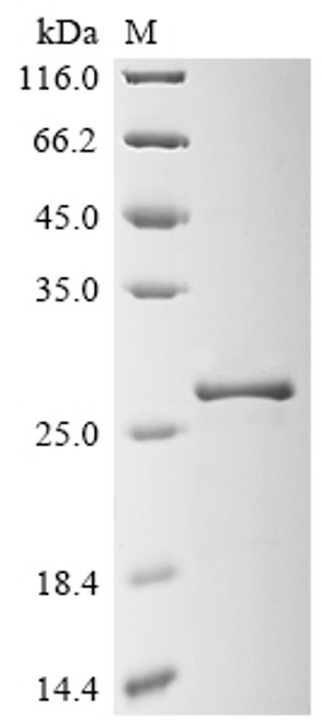 Recombinant Vicia faba Legumin type B (LEB6), partial (CSB-EP323408VFJ) Recombinant Vicia faba Legumin type B (LEB6), partial (CSB-EP323408VFJ)