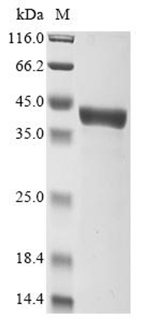 Recombinant Escherichia coli Glycine betaine/proline betaine-binding periplasmic protein (proX) (CSB-EP365322ENV)