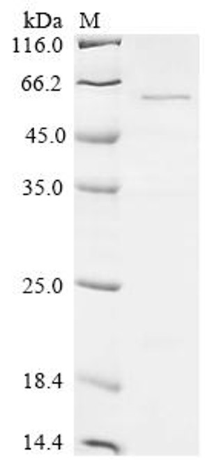 Recombinant Mumps virus Fusion glycoprotein F0 (F), partial (CSB-EP322556MJM)