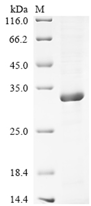 Recombinant Human Chymotrypsin-like elastase family member 2B (CELA2B) (CSB-EP362355HUb1)