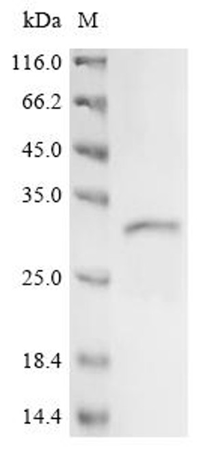 Recombinant Human Solute carrier family 22 member 1 (SLC22A1), partial (CSB-EP021442HU1)